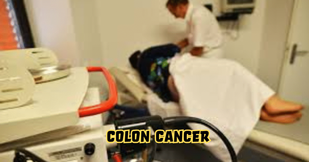 Colon Cancer