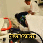The New Frontier of Prevention: Why Colon Cancer Tests Are Now Mailed to Patients’ Homes