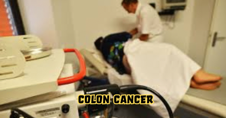 Colon Cancer
